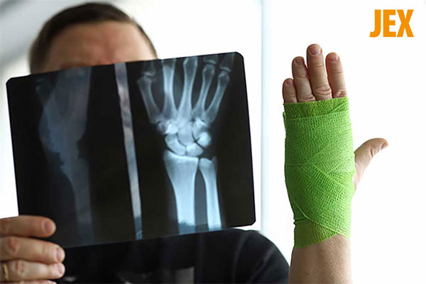 Chẩn đoán đau nhức cổ tay