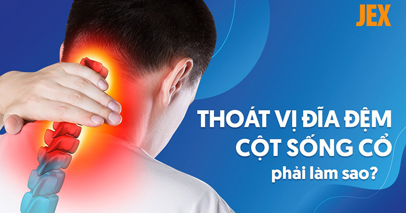 Thoát vị đĩa đệm cột sống cổ