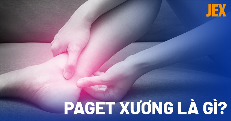 Paget xương là bệnh gì? Có nguy hiểm không?