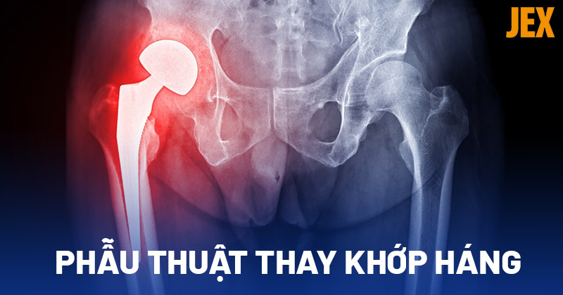 Phẫu thuật thay khớp háng