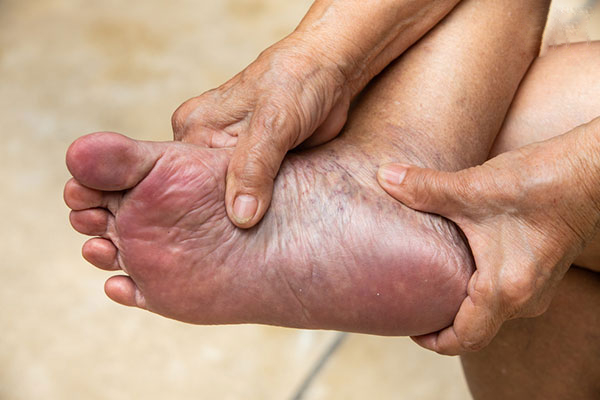 Hiện tượng thoái hóa khớp cổ chân