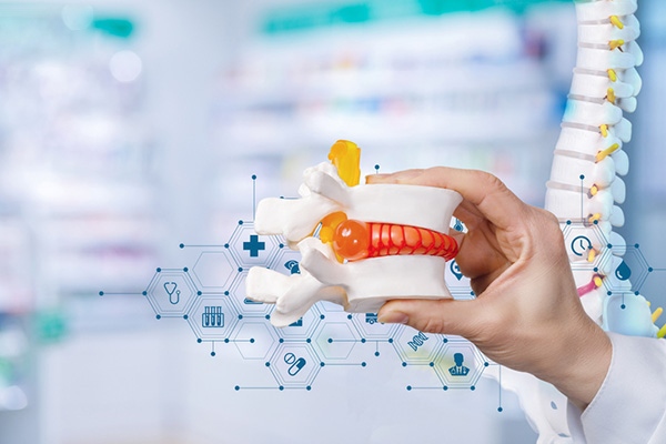 10 cách chữa thoát vị đĩa đệm L4 L5 an toàn, phổ biến hiện nay