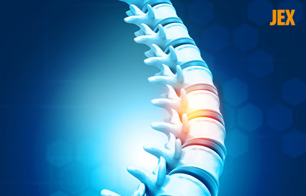 Gai cột sống: Triệu chứng, nguyên nhân và cách điều trị