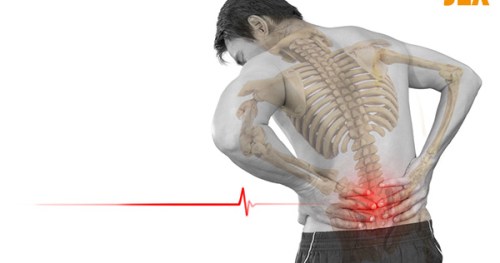 Đau lưng không cúi được: Nguyên nhân và cách điều trị như thế nào?