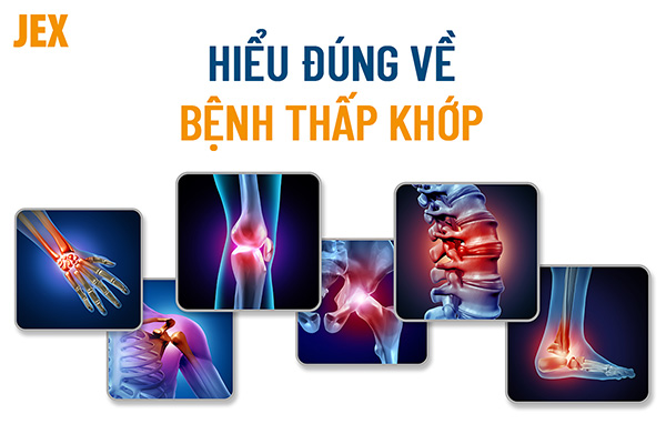 Bệnh thấp khớp là gì? Nguyên nhân, triệu chứng và cách cải thiện bệnh