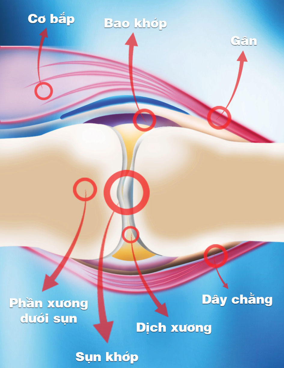 Khớp, sụn khớp & xương dưới sụn