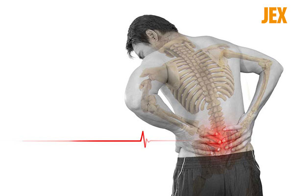 Hội chứng thắt lưng hông – Các vấn đề ở cột sống và rễ thần kinh