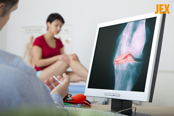 Thay khớp gối nhân tạo – Làm gì để phục hồi nhanh và duy trì lâu được lâu?