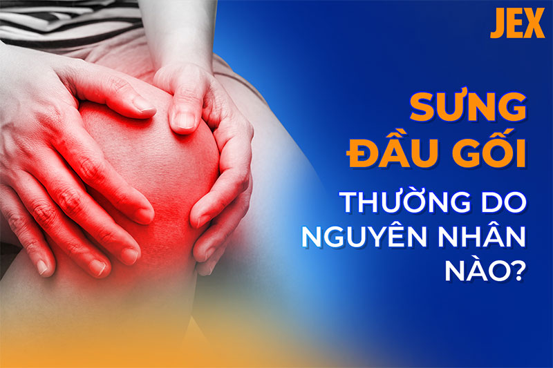 Sưng đầu gối là bệnh gì? Nguyên nhân, dấu hiệu và phòng ngừa