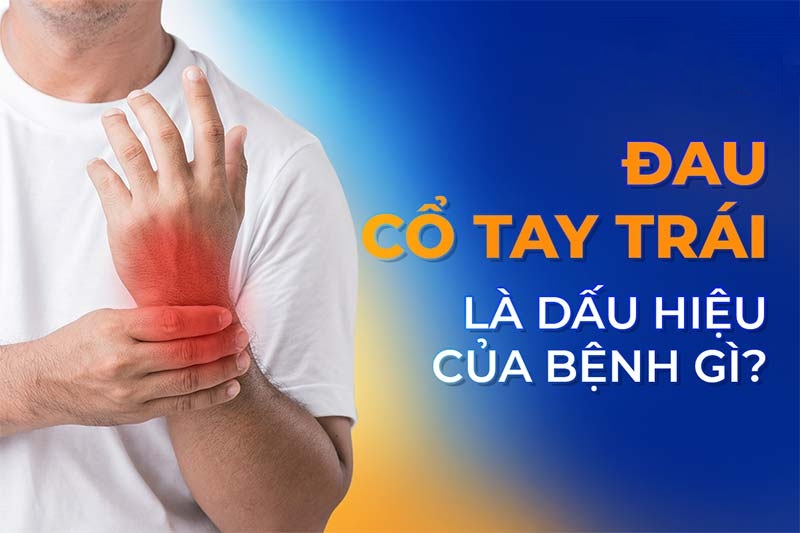 Đau cổ tay trái: Nguyên nhân, dấu hiệu và cách điều trị
