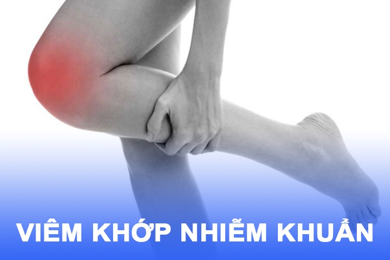Bệnh viêm khớp nhiễm khuẩn