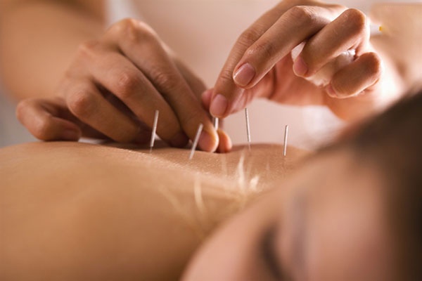 Phương pháp điều trị gai cột sống