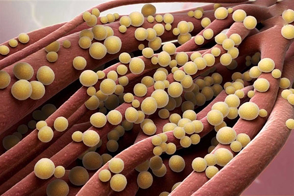 Vi khuẩn xâm nhập gây viêm khớp