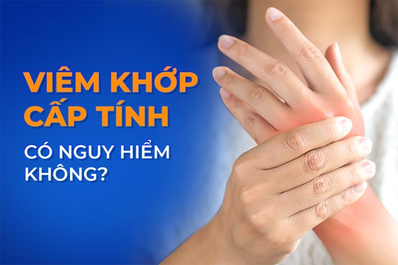 Viêm khớp cấp tính: Nguyên nhân, dấu hiệu, điều trị, phòng ngừa