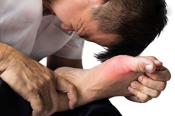 Bệnh gout (gút) – Nguyên nhân, chẩn đoán và điều trị