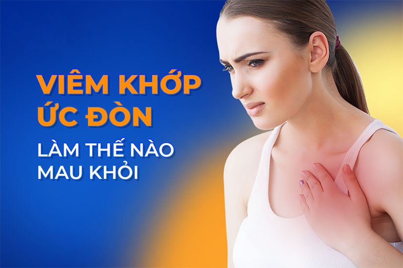 Viêm khớp ức đòn: Nguyên nhân, dấu hiệu và cách điều trị