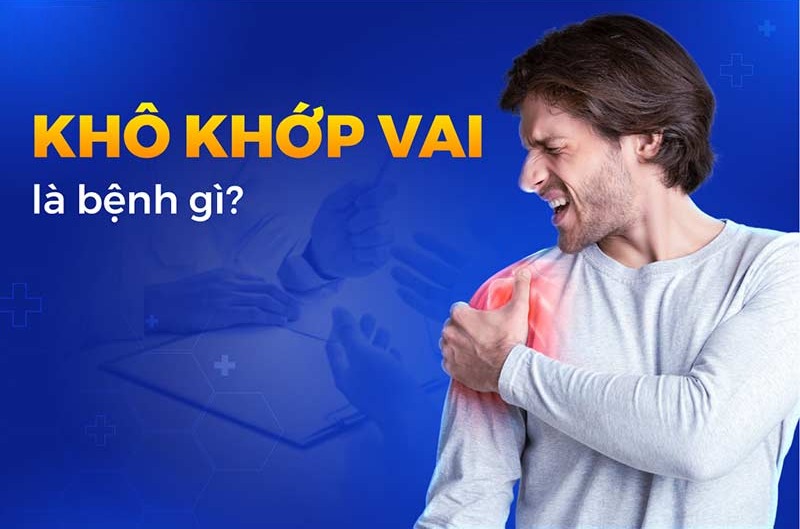 Khô khớp vai: Nguyên nhân, dấu hiệu và cách điều trị
