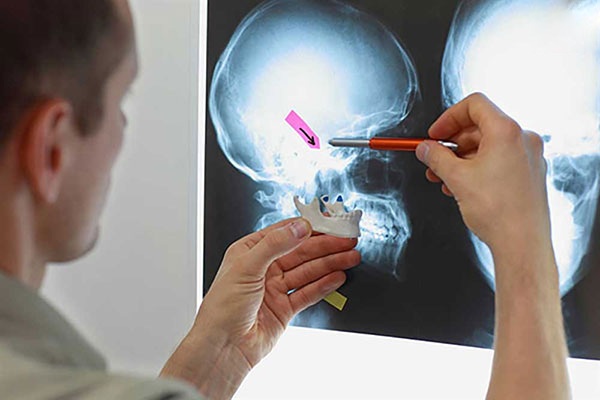 Phương pháp chẩn đoán viêm khớp thái dương hàm