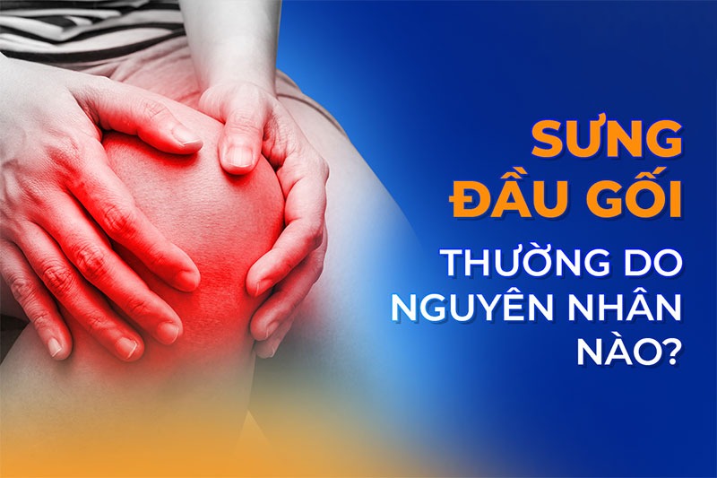 Sưng đầu gối là bệnh gì? Nguyên nhân, dấu hiệu và phòng ngừa