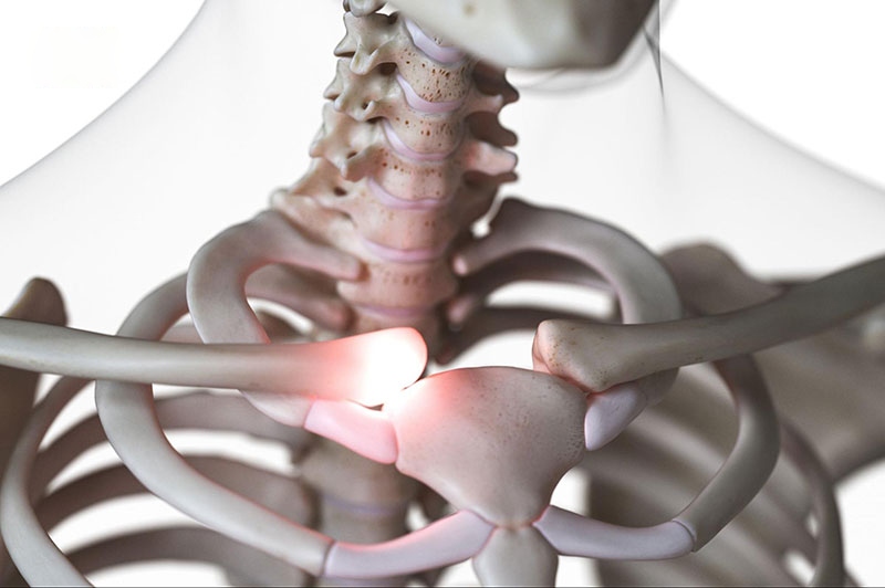 Vị trí ức đòn