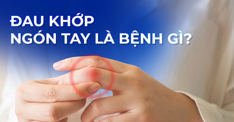Đau khớp ngón tay: Nguyên nhân, dấu hiệu và cách cải thiện