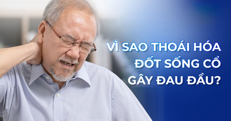 Thoái hóa đốt sống cổ gây đau đầu