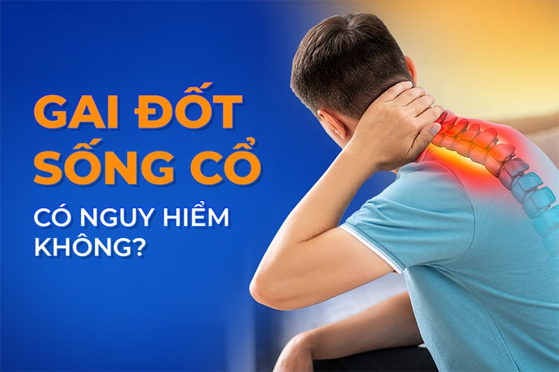 Gai đốt sống cổ: Nguyên nhân, triệu chứng và cách phòng ngừa