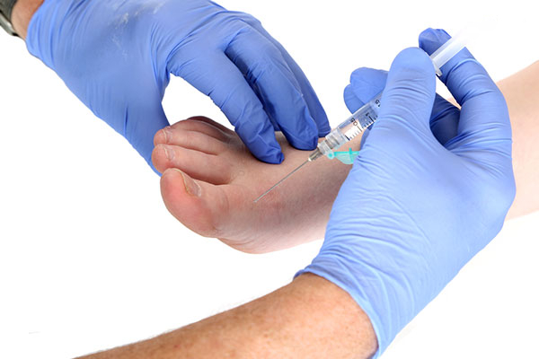 Điều trị thoái hóa xương khớp