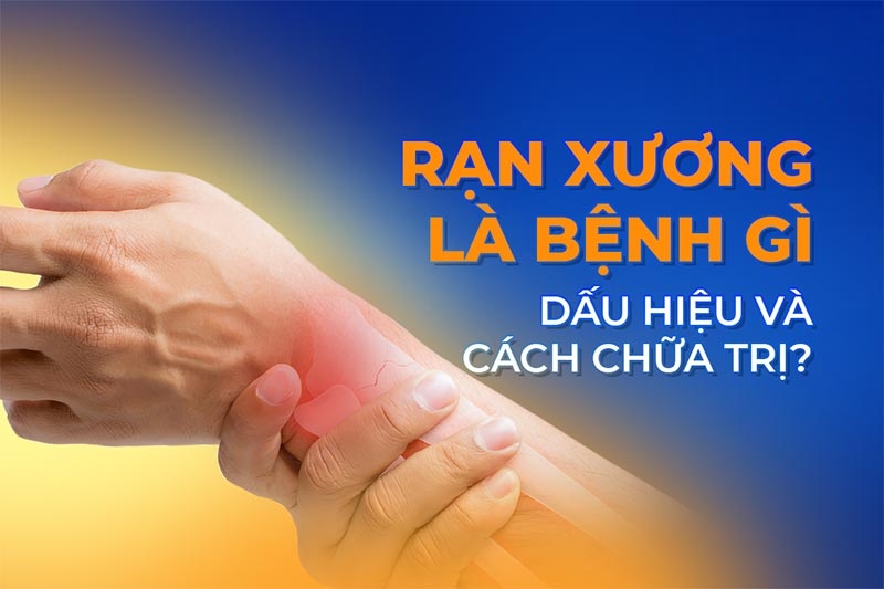 Rạn xương: Nguyên nhân, dấu hiệu và cách cải thiện