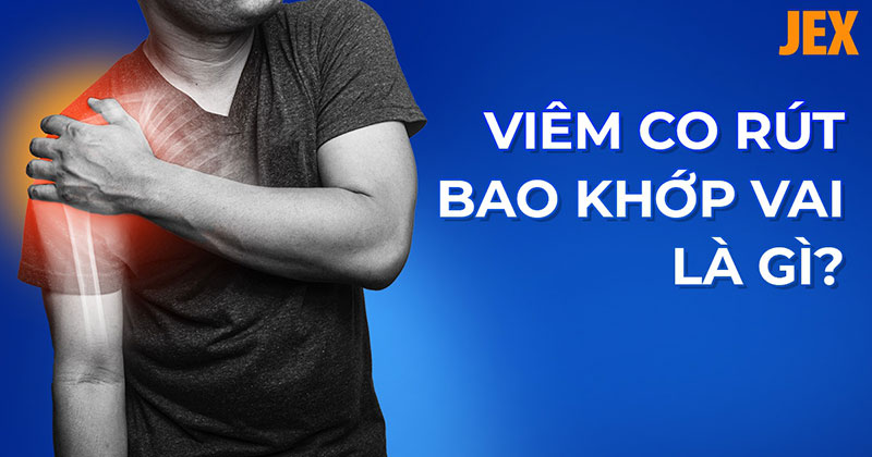 Viêm co rút bao khớp vai: Nguyên nhân, dấu hiệu và cách cải thiện