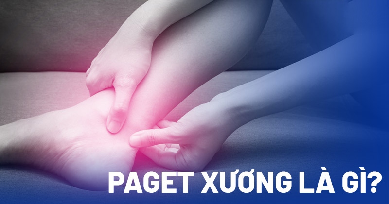 Paget xương là bệnh gì? Có nguy hiểm không?