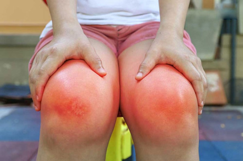 Triệu chứng viêm khớp dạng thấp