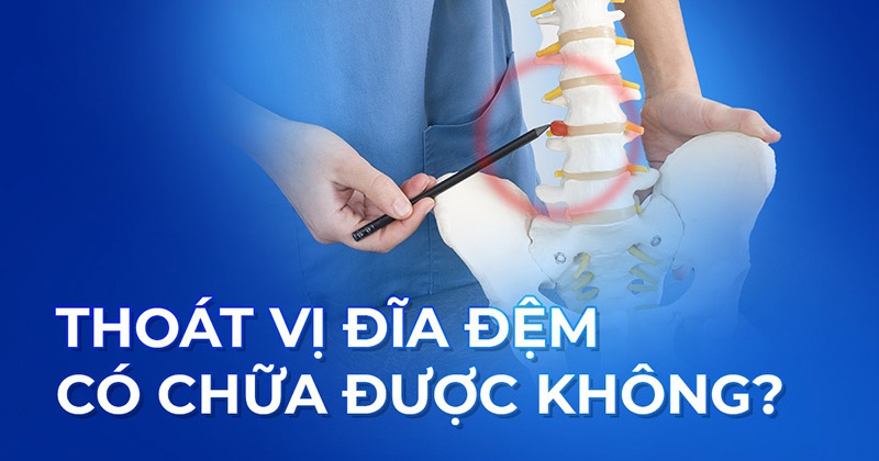 Thoát vị đĩa đệm có chữa được không? Có trị dứt điểm hoàn toàn?