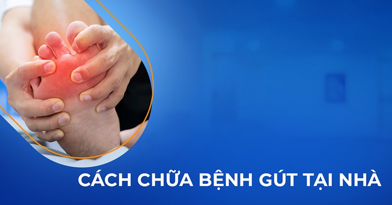 18 cách chữa bệnh gút dứt điểm tại nhà nhanh chóng bạn có biết