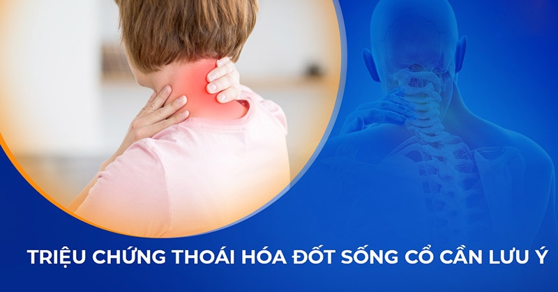 10 triệu chứng thoái hóa đốt sống cổ thường gặp không nên bỏ qua