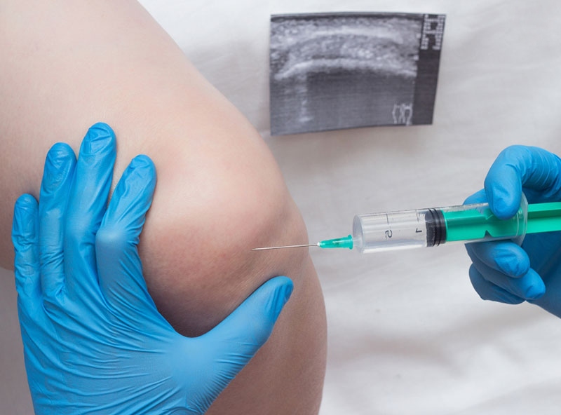 Bác sĩ tiêm tế bào gốc vào khớp gối