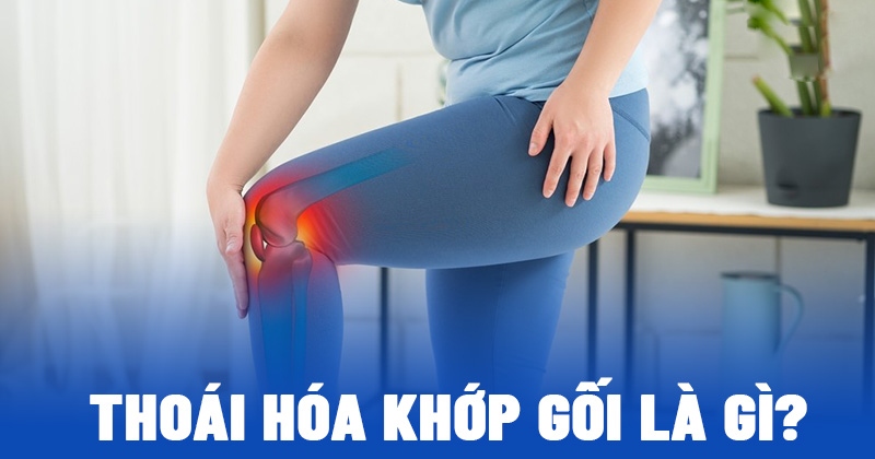 Thoái hóa khớp gối: Nguyên nhân, triệu chứng và điều trị