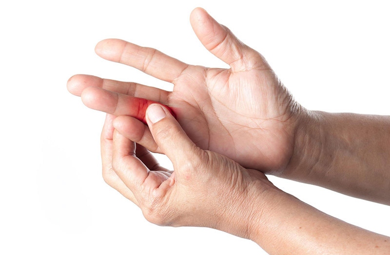 Các khớp ngón tay đeo nhẫn đau nhức