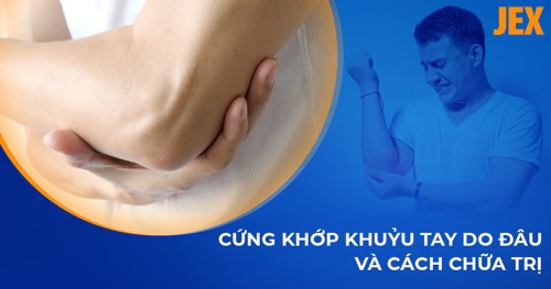 Cứng khớp khuỷu tay: Nguyên nhân, dấu hiệu và cách điều trị
