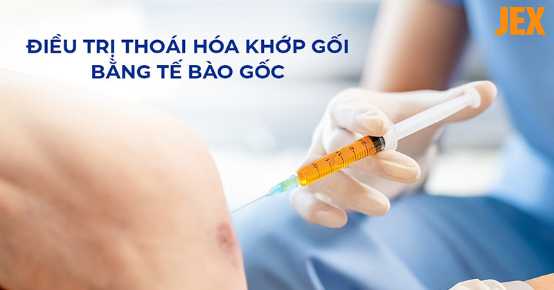 Điều trị thoái hóa khớp gối bằng tế bào gốc là gì? Khi nào nên sử dụng?