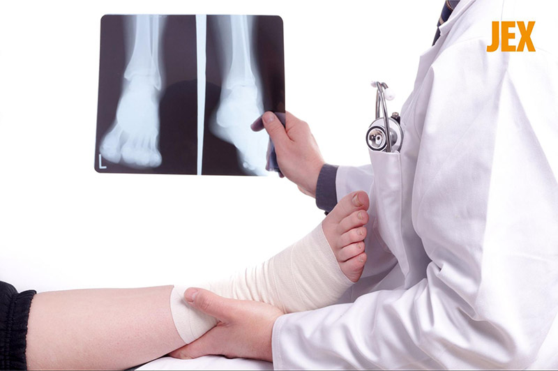 Cách chẩn đoán chấn thương cổ chân