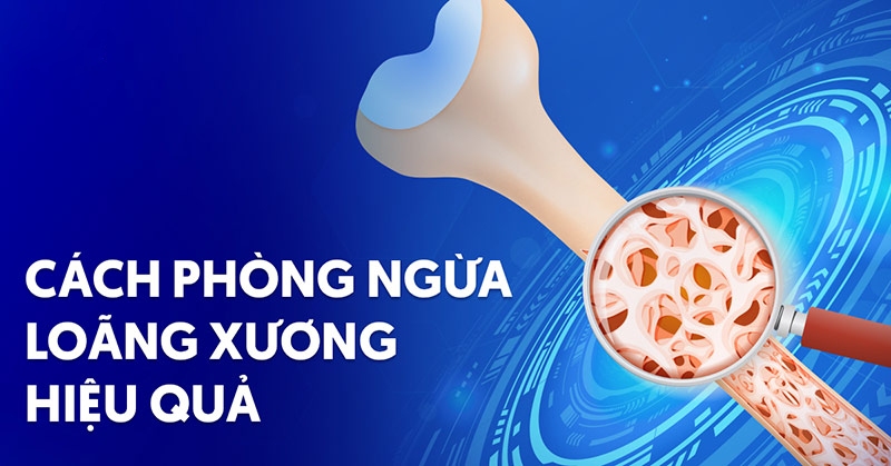 8 cách phòng ngừa loãng xương hiệu quả