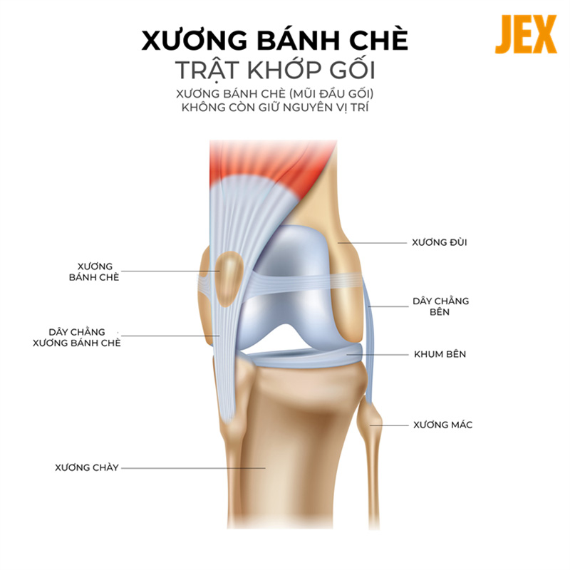 Cấu tạo cơ bản của khớp