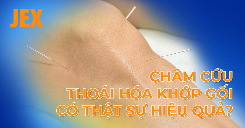 Châm cứu thoái hóa khớp gối có giúp điều trị bệnh hiệu quả không?