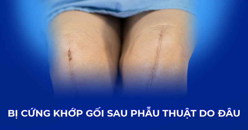 Bị cứng khớp gối sau phẫu thuật: Nguyên nhân, triệu chứng và điều trị