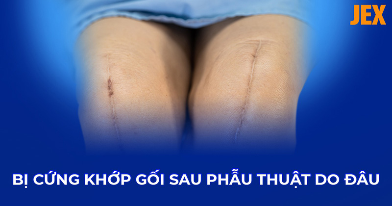 Bị cứng khớp gối sau phẫu thuật: Nguyên nhân, triệu chứng và điều trị
