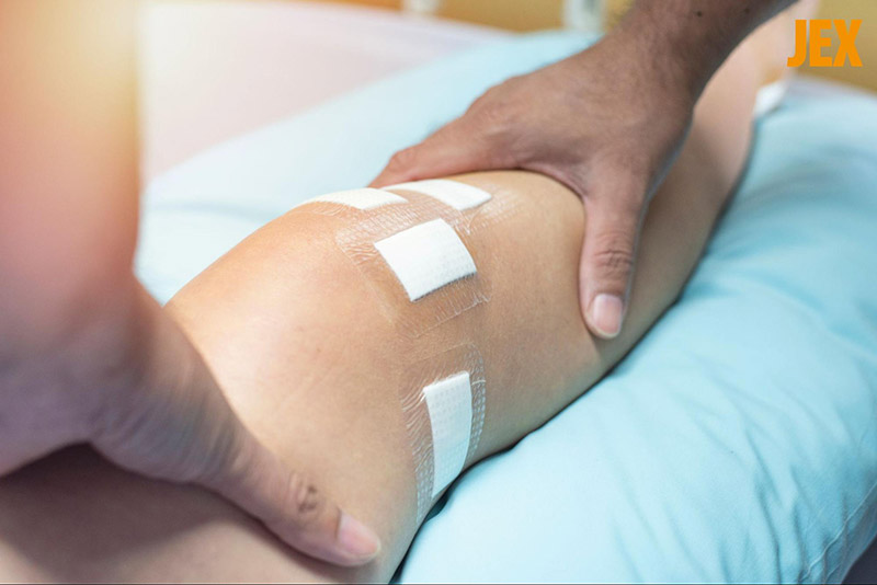 Tình trạng cứng khớp gối sau phẫu thuật