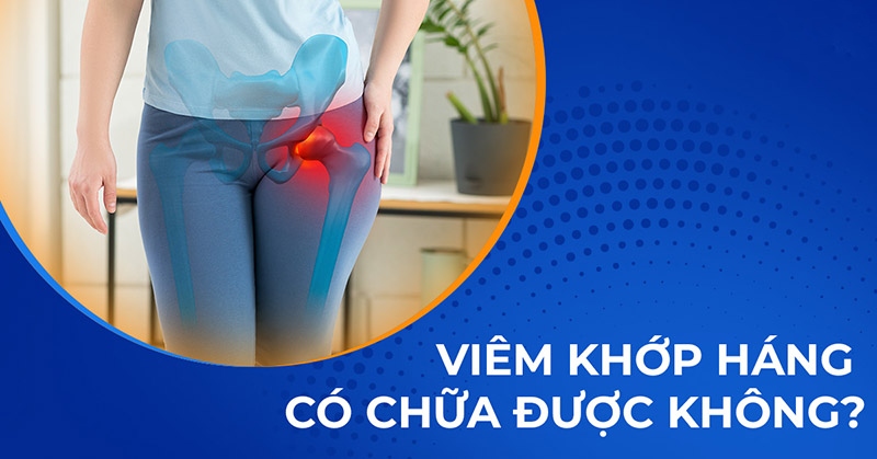 Bệnh viêm khớp háng có chữa được không? Có khỏi được hoàn toàn?