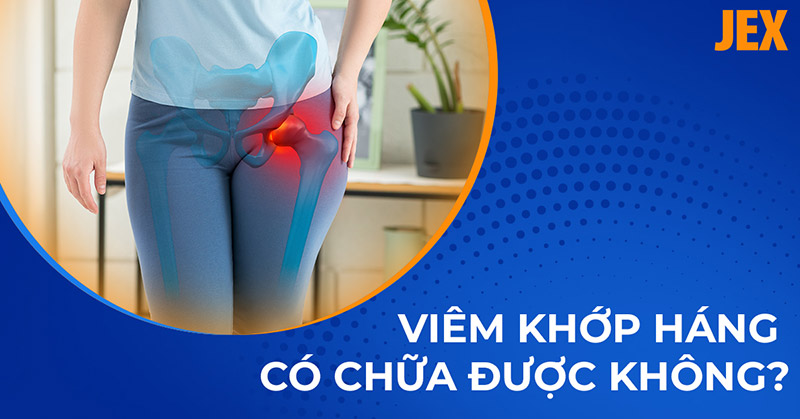 Bệnh viêm khớp háng có chữa được không? Có khỏi được hoàn toàn?