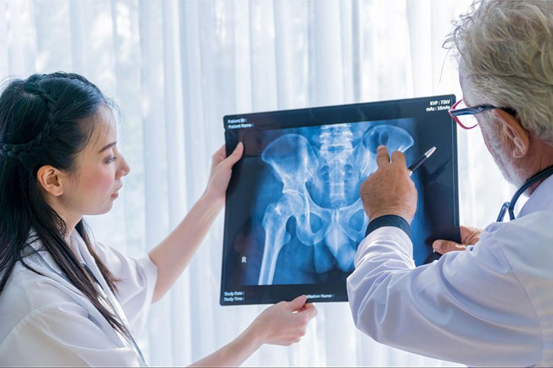 Chẩn đoán hình ảnh xác định viêm khớp sau chấn thương